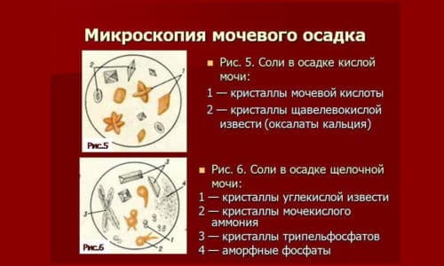 Красящими свойствами также обладают такие продукты, как свекла, морковь, ревень, черника и ежевика, после которых помутнение урины не наблюдается, но она может приобрести темно-красный оттенок