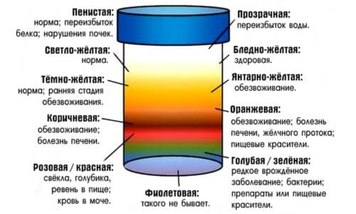 Выделение урины темно-желтого оттенка не всегда является признаком патологии и может иметь естественный характер