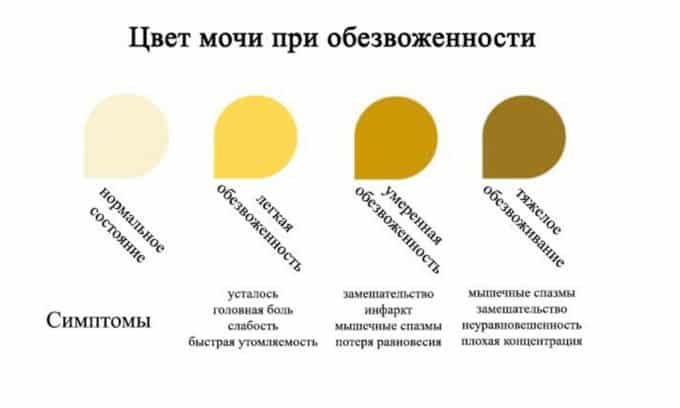 Темный оттенок без изменения состава мочи указывает на обезвоживание. Факторами риска являются жаркая погода и работа в горячих цехах, когда уровень жидкости в организме требует особого контроля