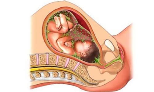 Самую большую опасность представляет влияние цистита на другие органы и на будущего ребенка, поскольку болезненная микрофлора проникает через плаценту