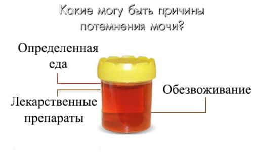 В норме урина человека прозрачная и имеет соломенно-желтый цвет