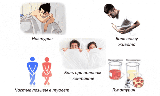 Симптомы при цистите